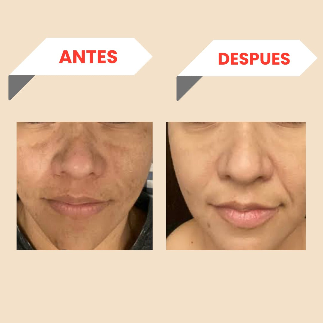 CREMA ACLARADORA DE MI MÁ